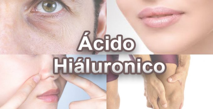 distintas zonas del cuerpo donde aplicar acido hialuronico